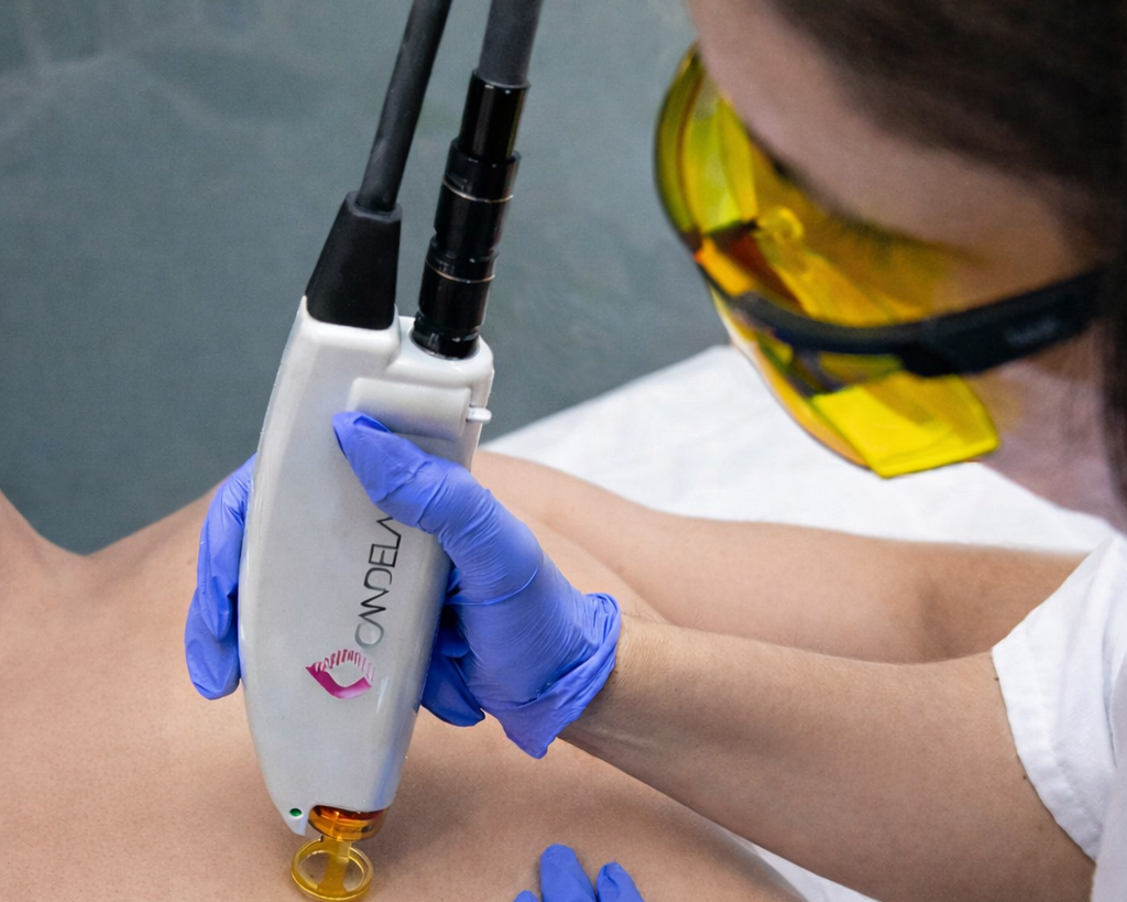 Skin care treatment