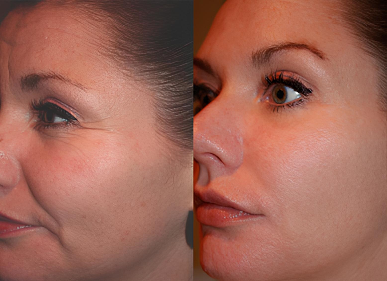 Skin care treatment